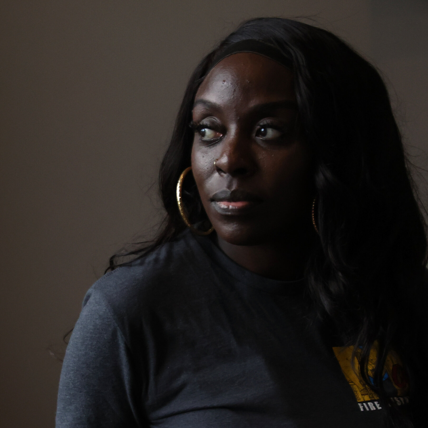 Pregnancy With Lupus Is Risky. Would She Be Able to Carry Her Baby to Term?