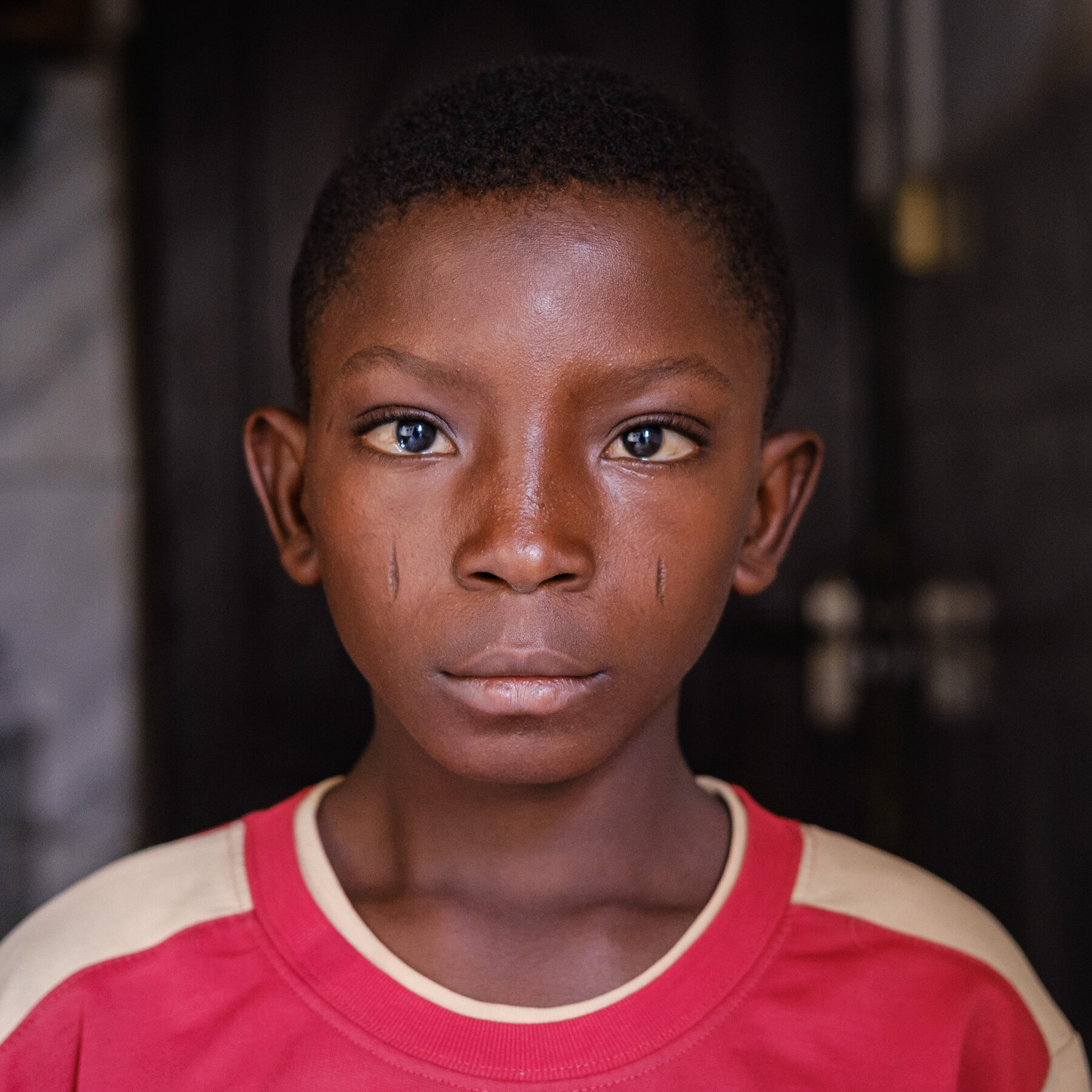 When a Simple Swim Carries a Risk of Dangerous Illness