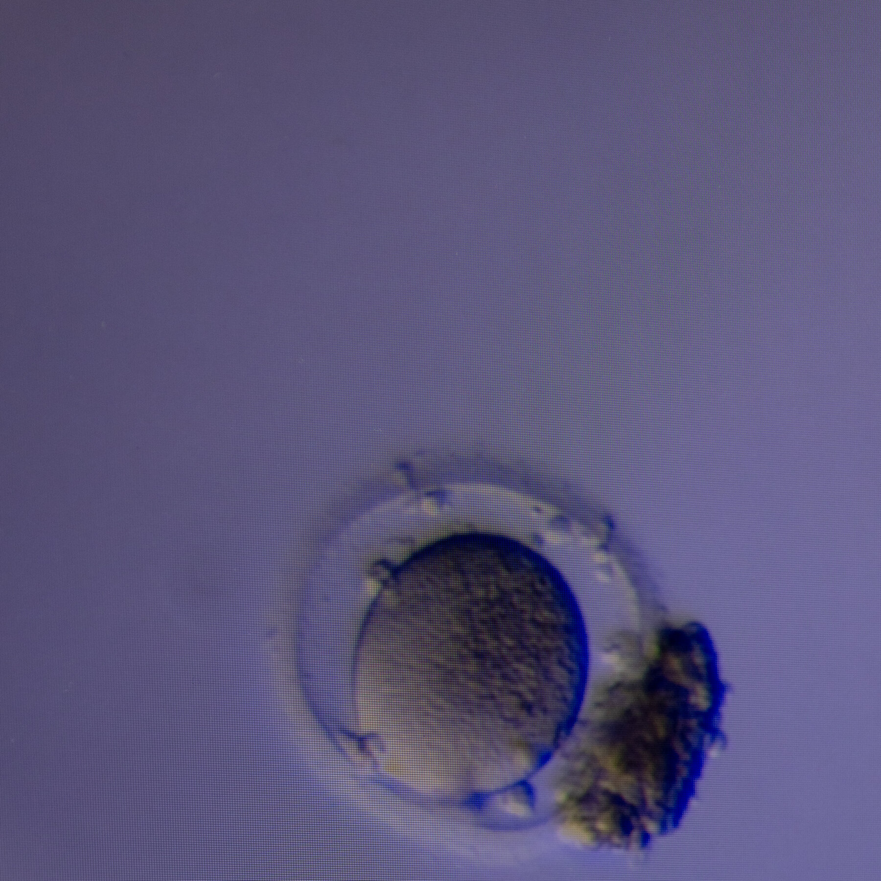 New Method Can Find Hidden Eggs to Aid in Fertility Treatment