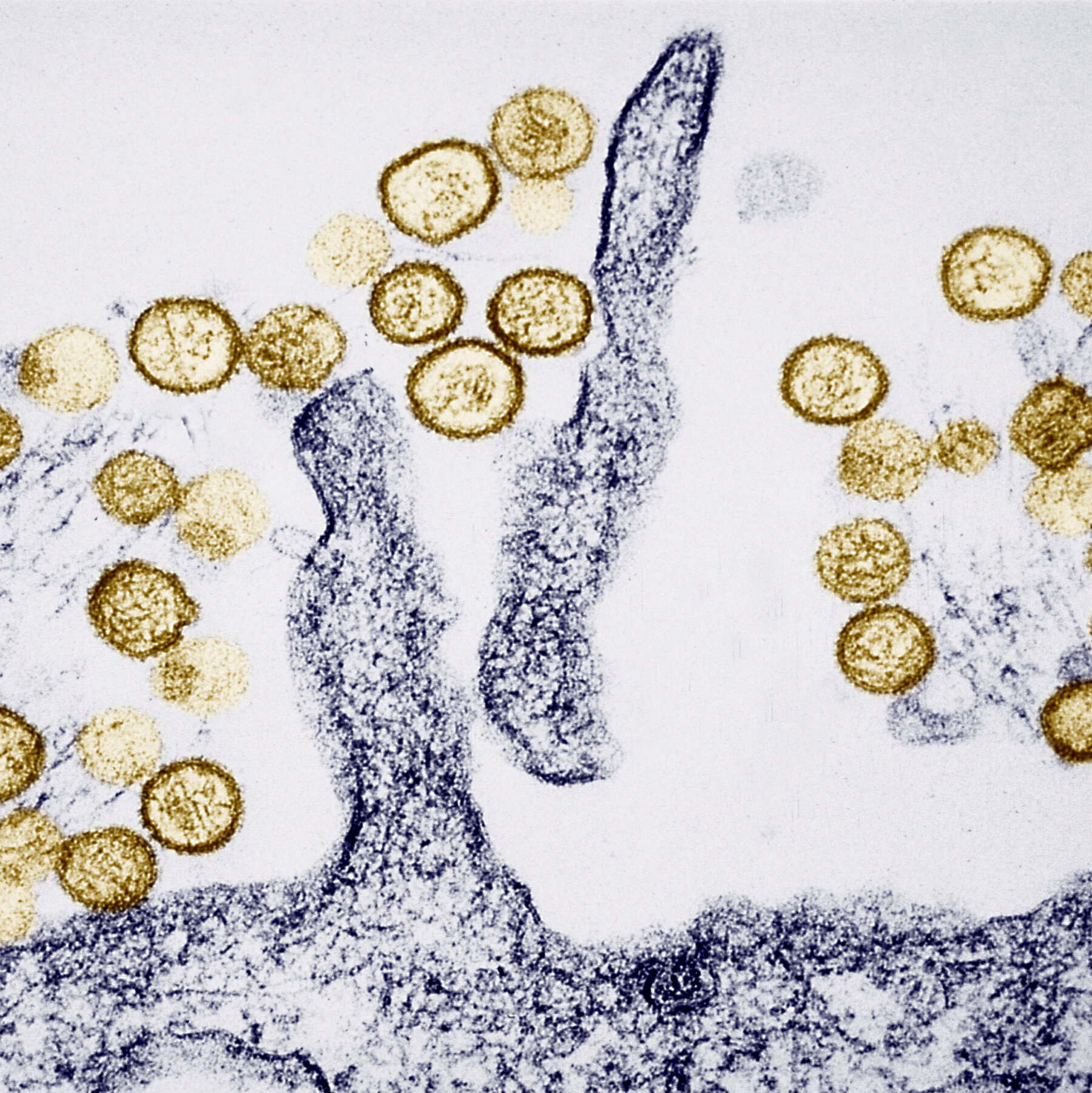 What Is Hantavirus, Which Is Linked to the Deaths of 3 People Aboard a Cruise Ship?
