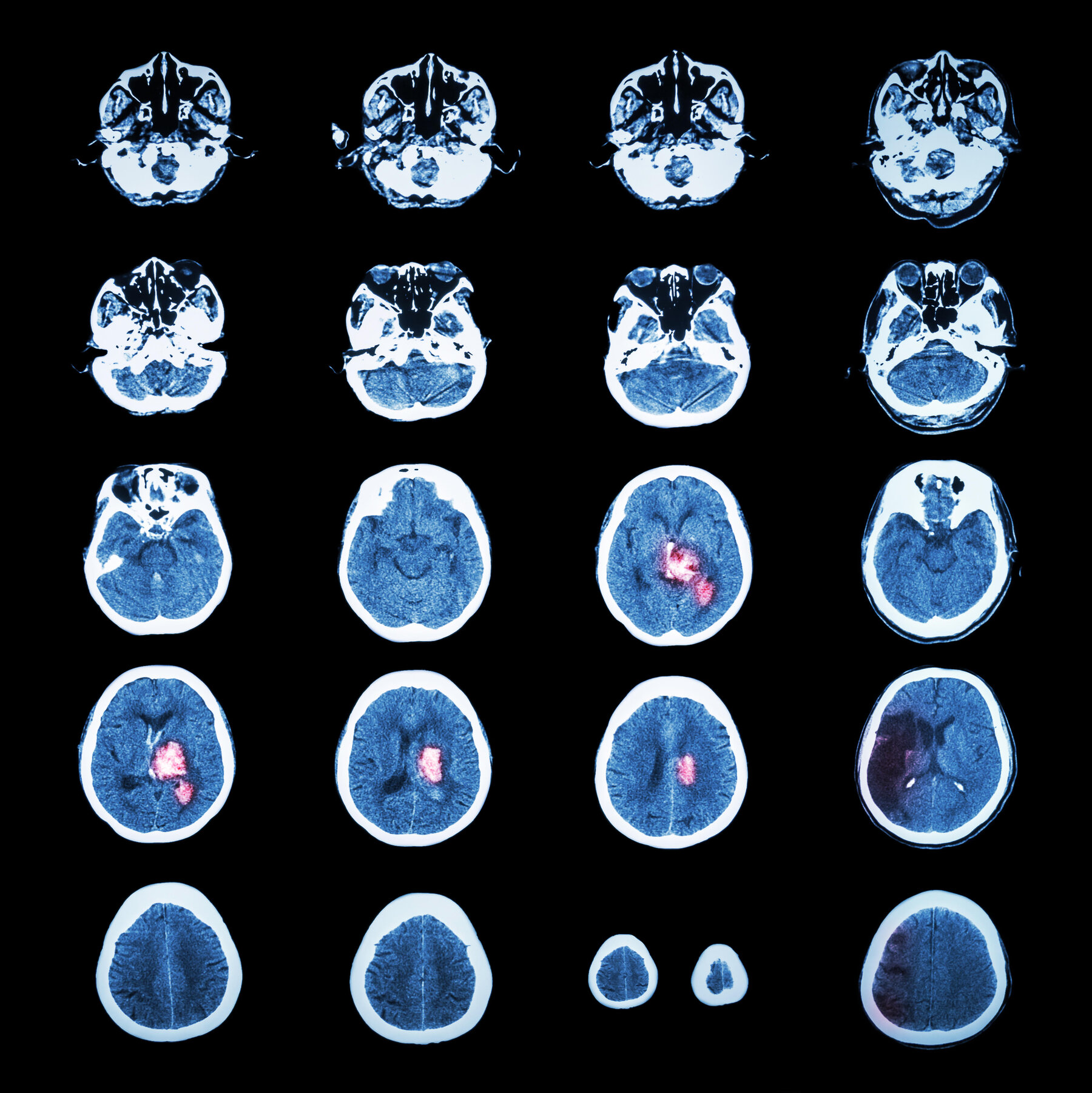 3 Psychiatric Tools That Could Boost the Brain’s Natural Healing