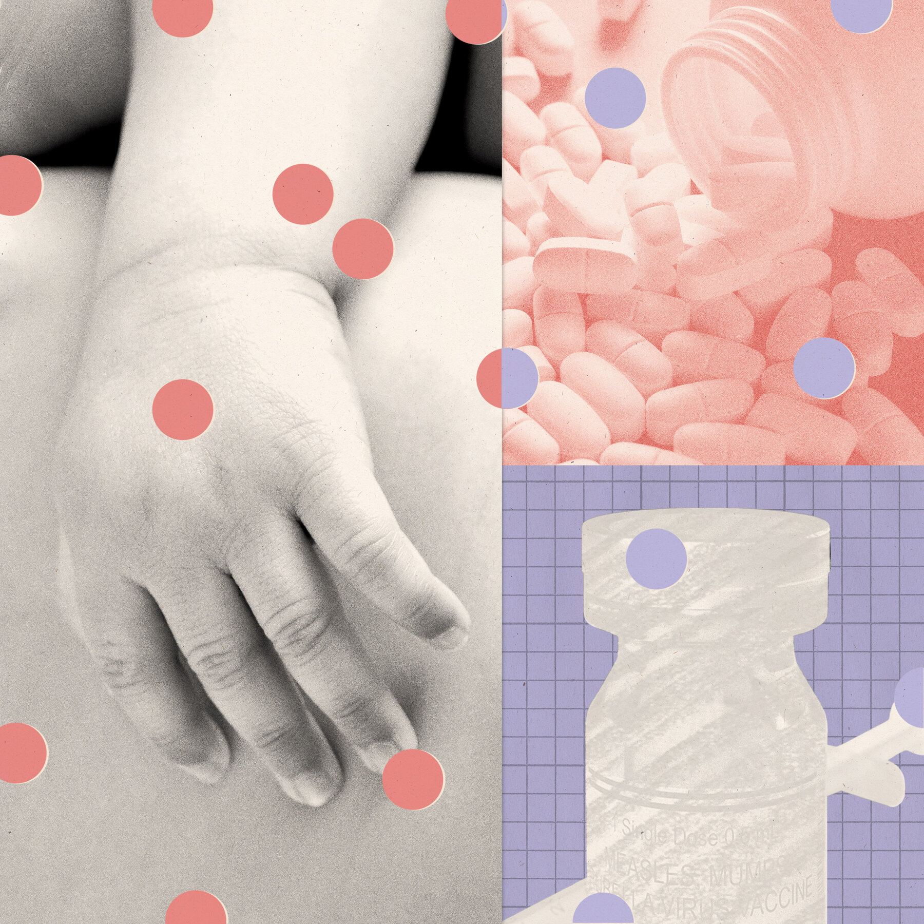 With Measles Roaring Back, the Search for a Drug is On