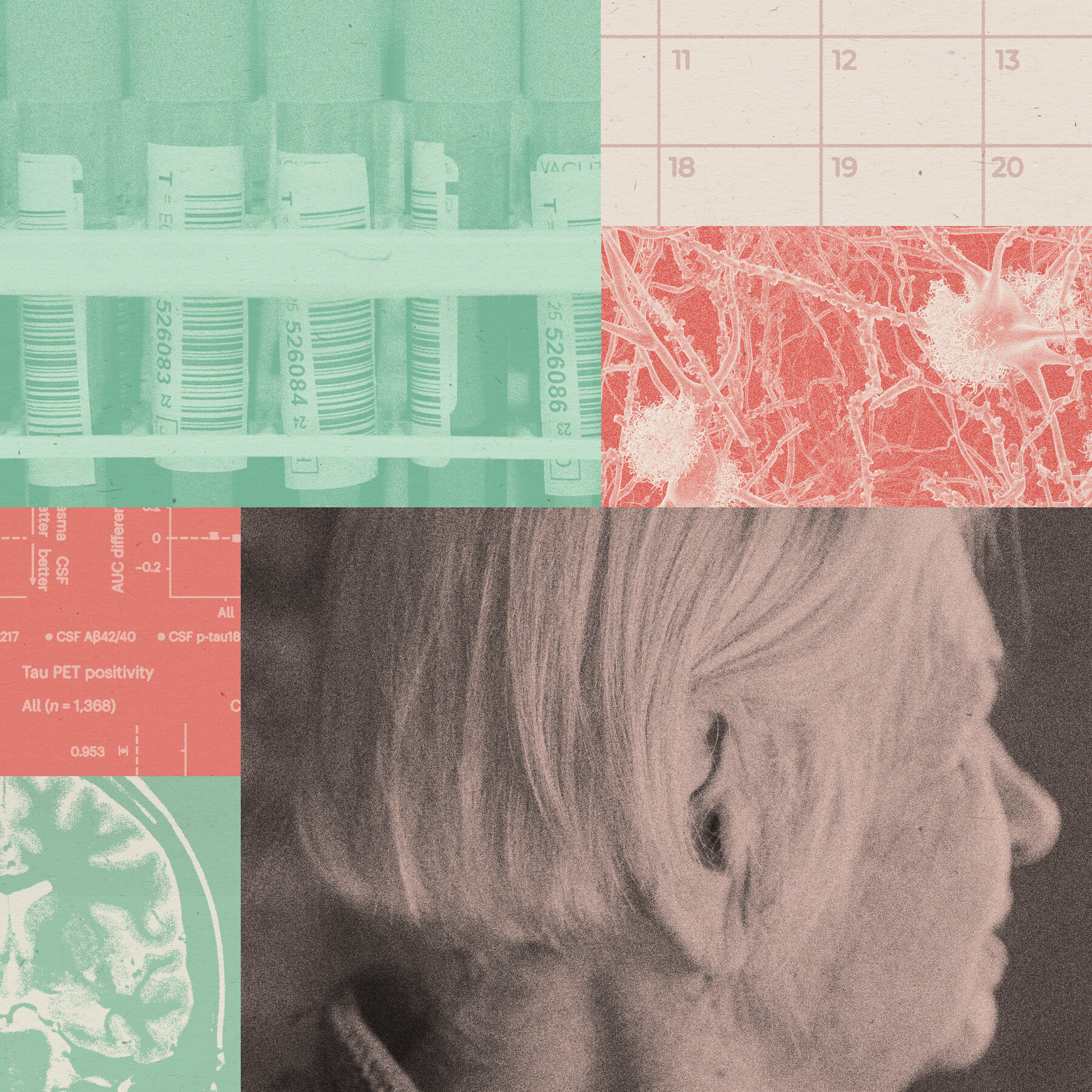 Alzheimer’s Blood Tests Offer New Promise to Diagnose and Predict the Disease