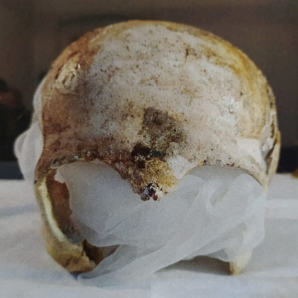 Man Stole Medieval Skull From Church and Sealed it in Concrete, Police Say