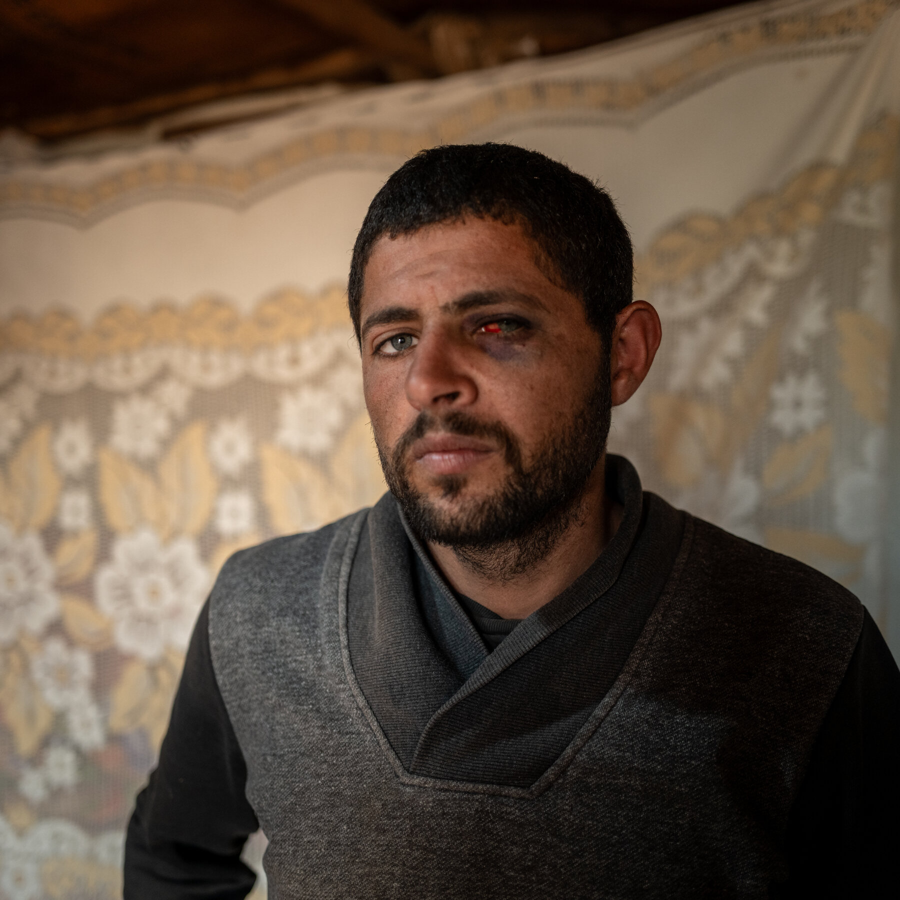 Palestinian Man Recounts Brutal Sexual Assault by Israeli Settlers
