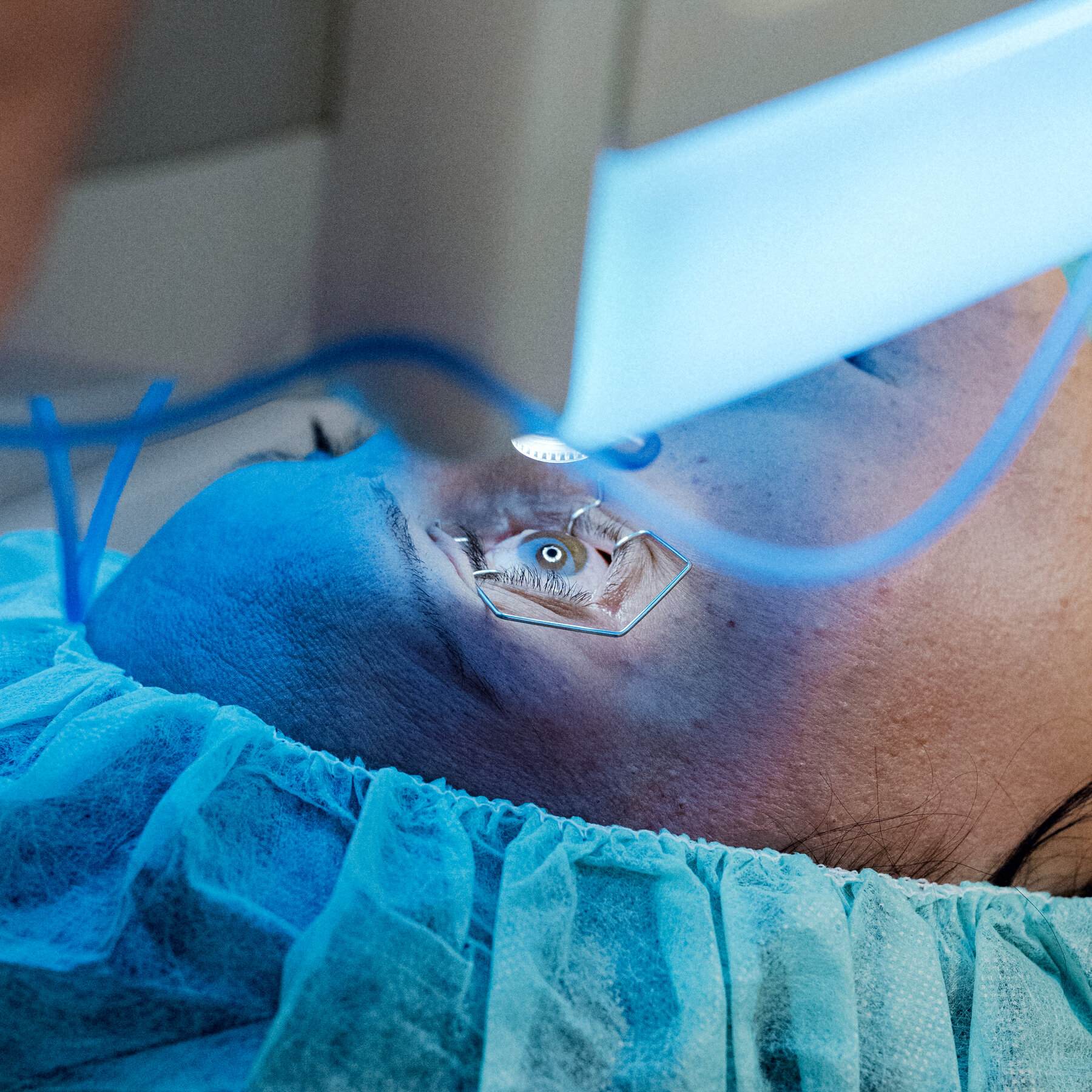 This Doctor Can Change the Color of Your Eyes. Should He?