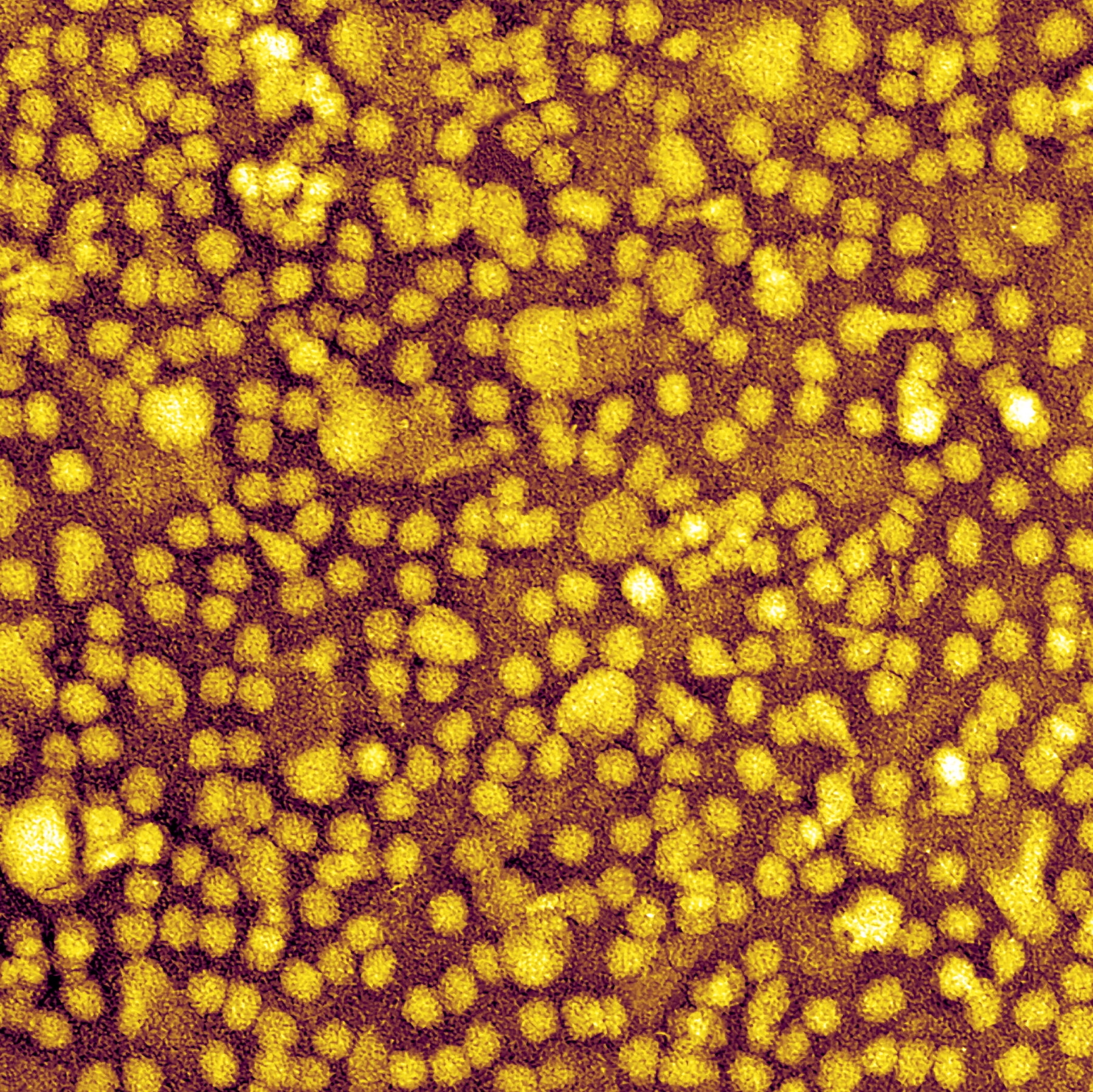 One-and-Done Heart Disease Prevention? Scientists Show It May Be Possible.