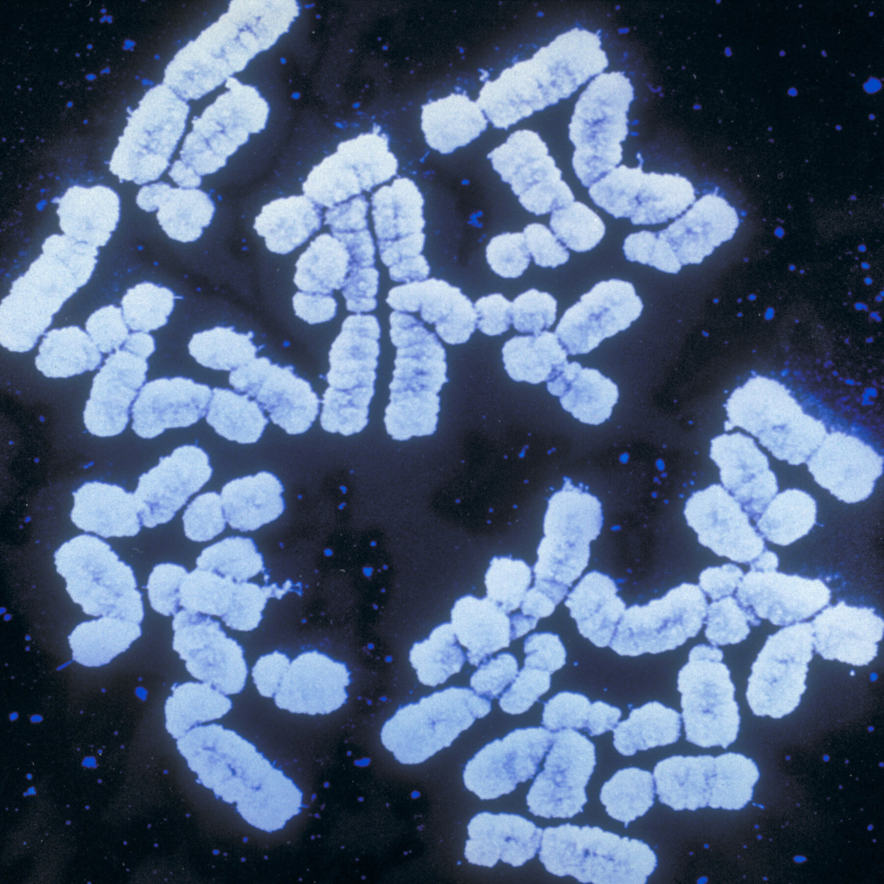 Genetic Scores are Booming. But Will Anti-Discrimination Laws Cover Your DNA?