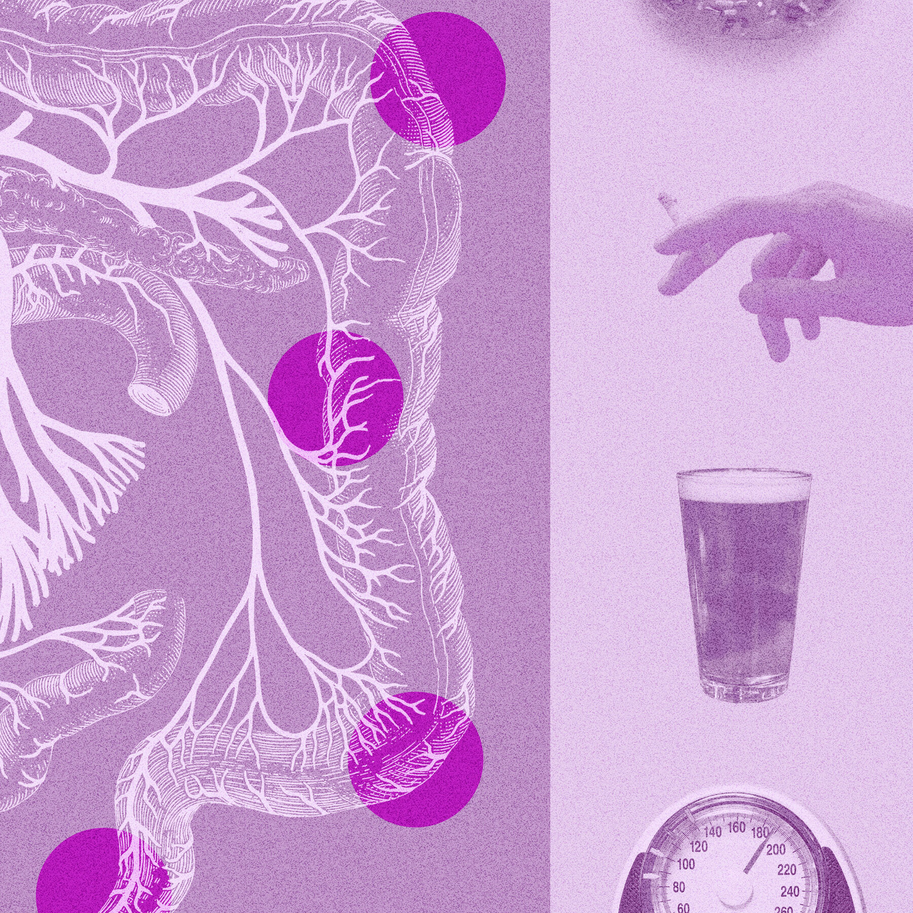 Half of Colorectal Cancer Cases Now Occur in Those Under 65, Study Shows