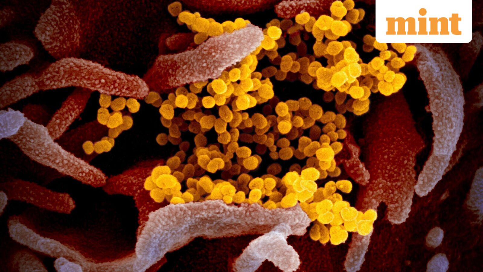 Hantavirus case update: 2 confirmed in UK, 3rd Briton suspected — How are different countries tackling the disease