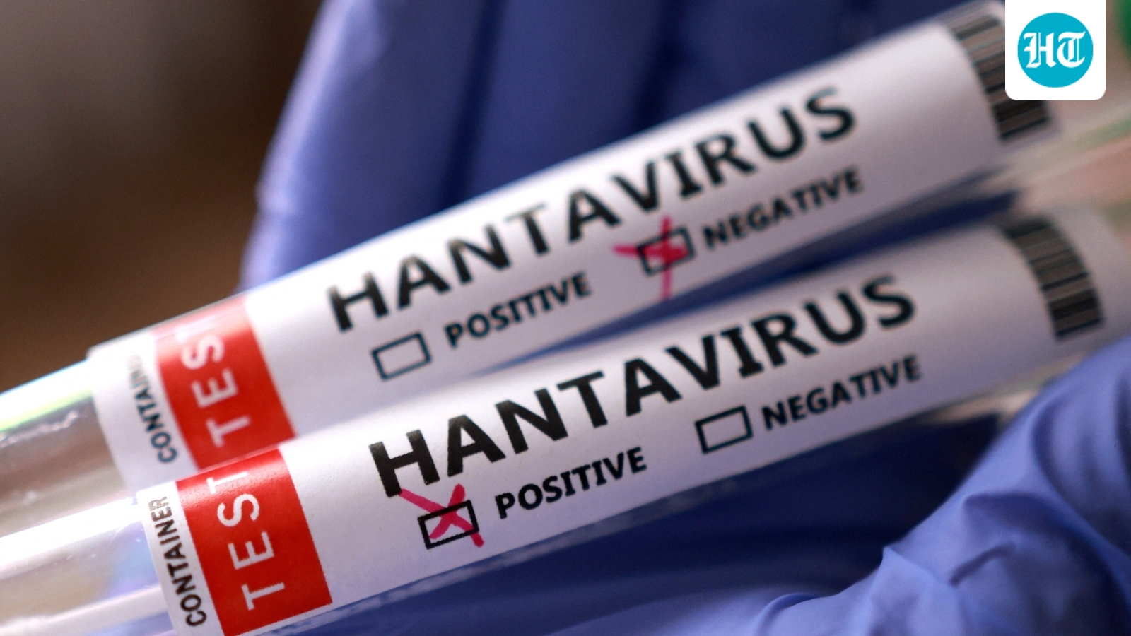 Hantavirus update: Is the cruise ship virus the next COVID? WHO says more cases ‘expected’
