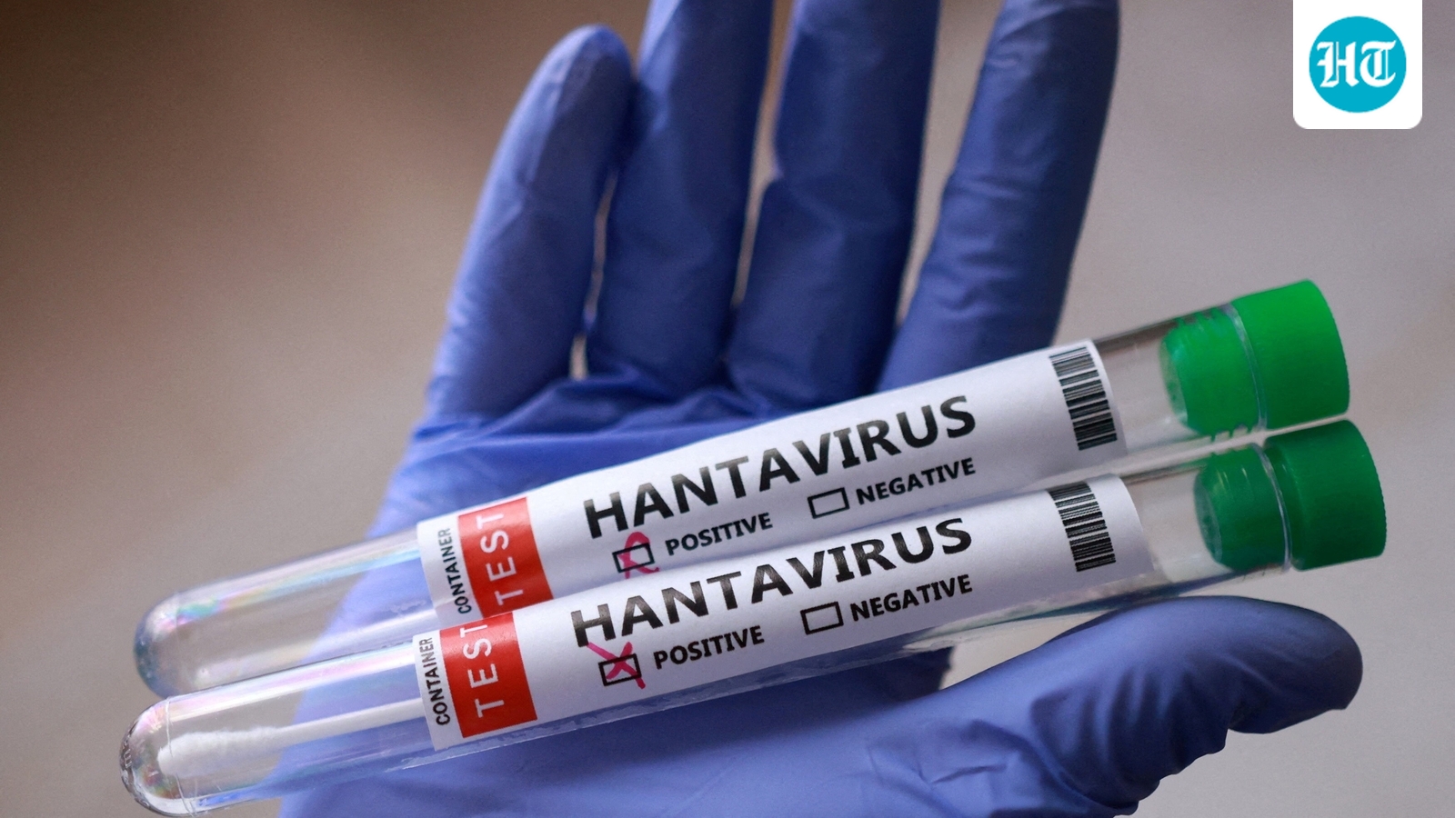Hantavirus update: List of countries, confirmed cases and deaths linked to MV Hondius outbreak
