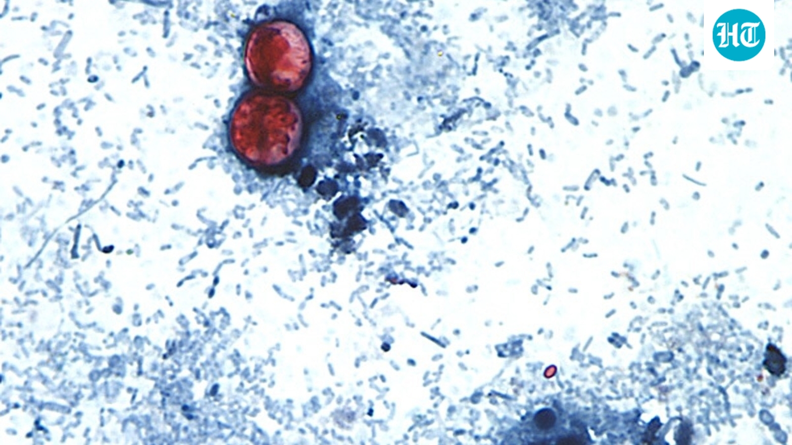 Cyclospora outbreak: Why haven't health officials identified the source yet? Explained