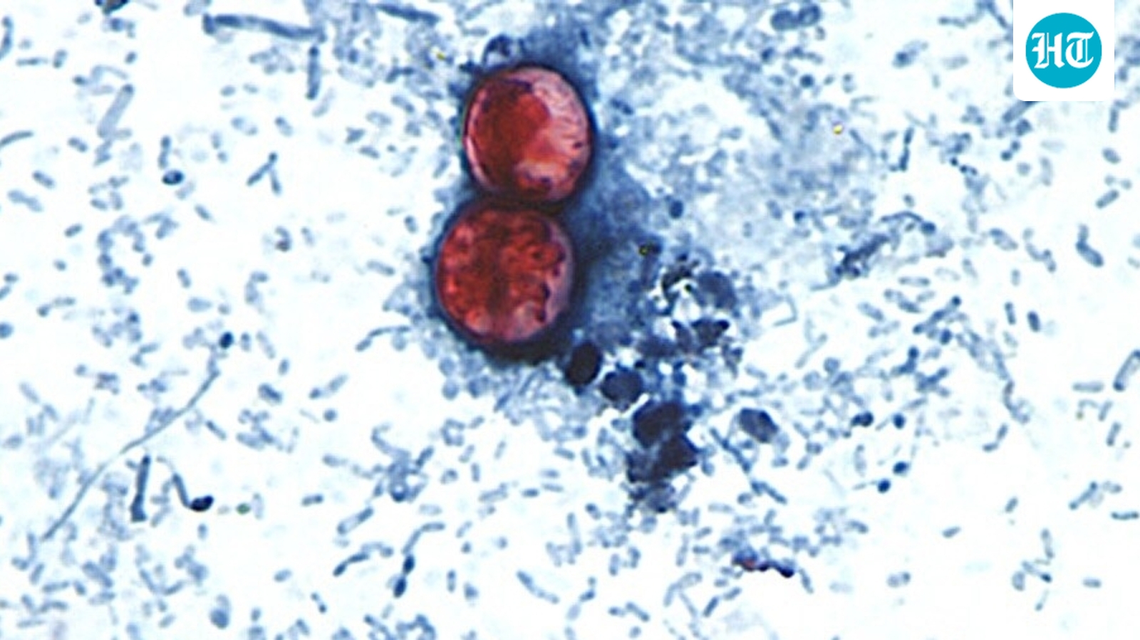 Thousands sickened with ‘explosive’ diarrhoea in the US: The parasite that thrives on salad greens & fruits