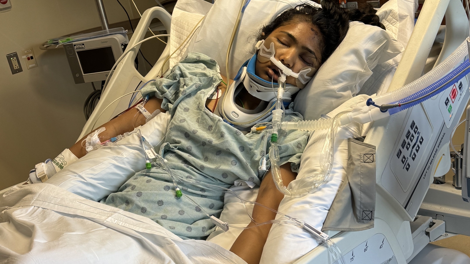 Who is Lagishetti Spandana? Indian student fights for life in US after tragic incident; GoFundMe launched