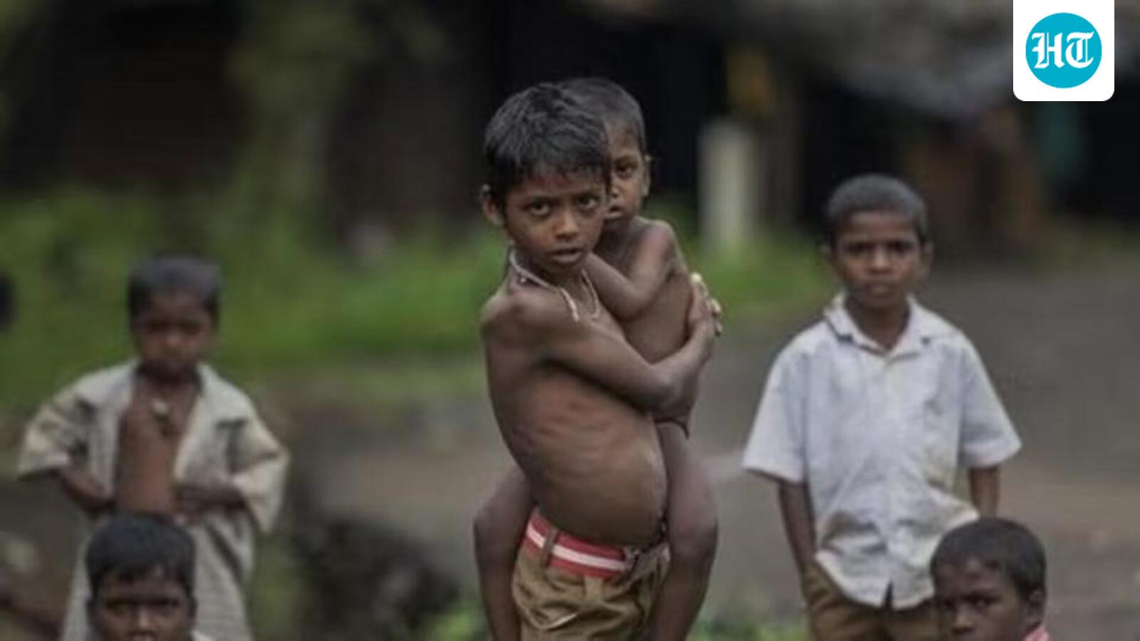 NFHS-6: Madhya Pradesh reports highest child malnutrition in India