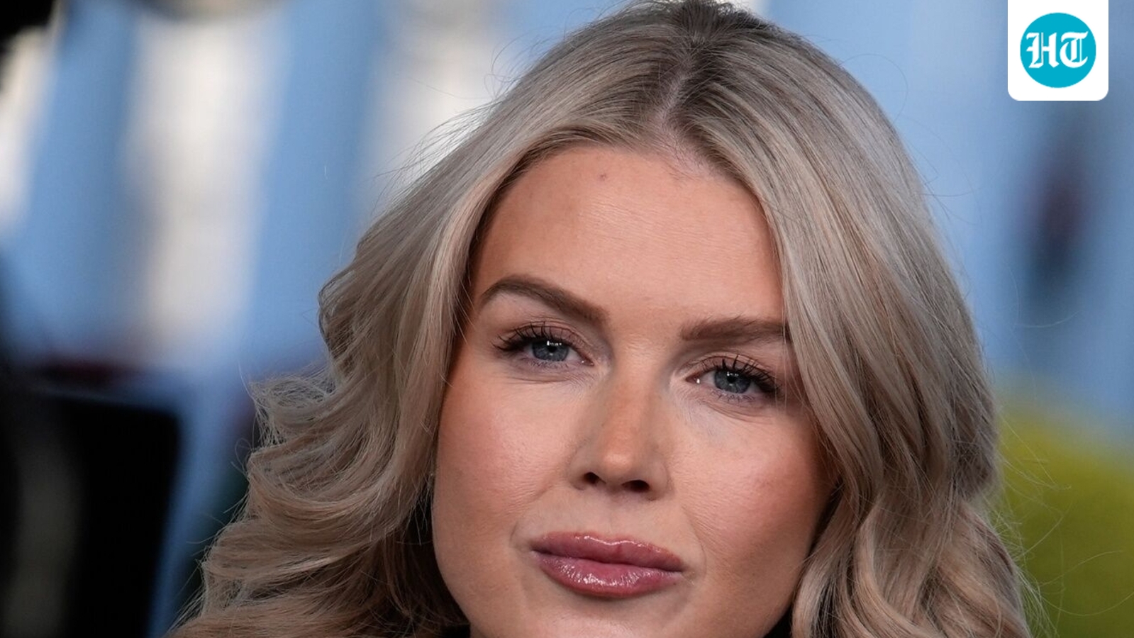 Karoline Leavitt lips: Experts weigh in on plastic surgery buzz; before-after pics go viral after Vanity Fair photo