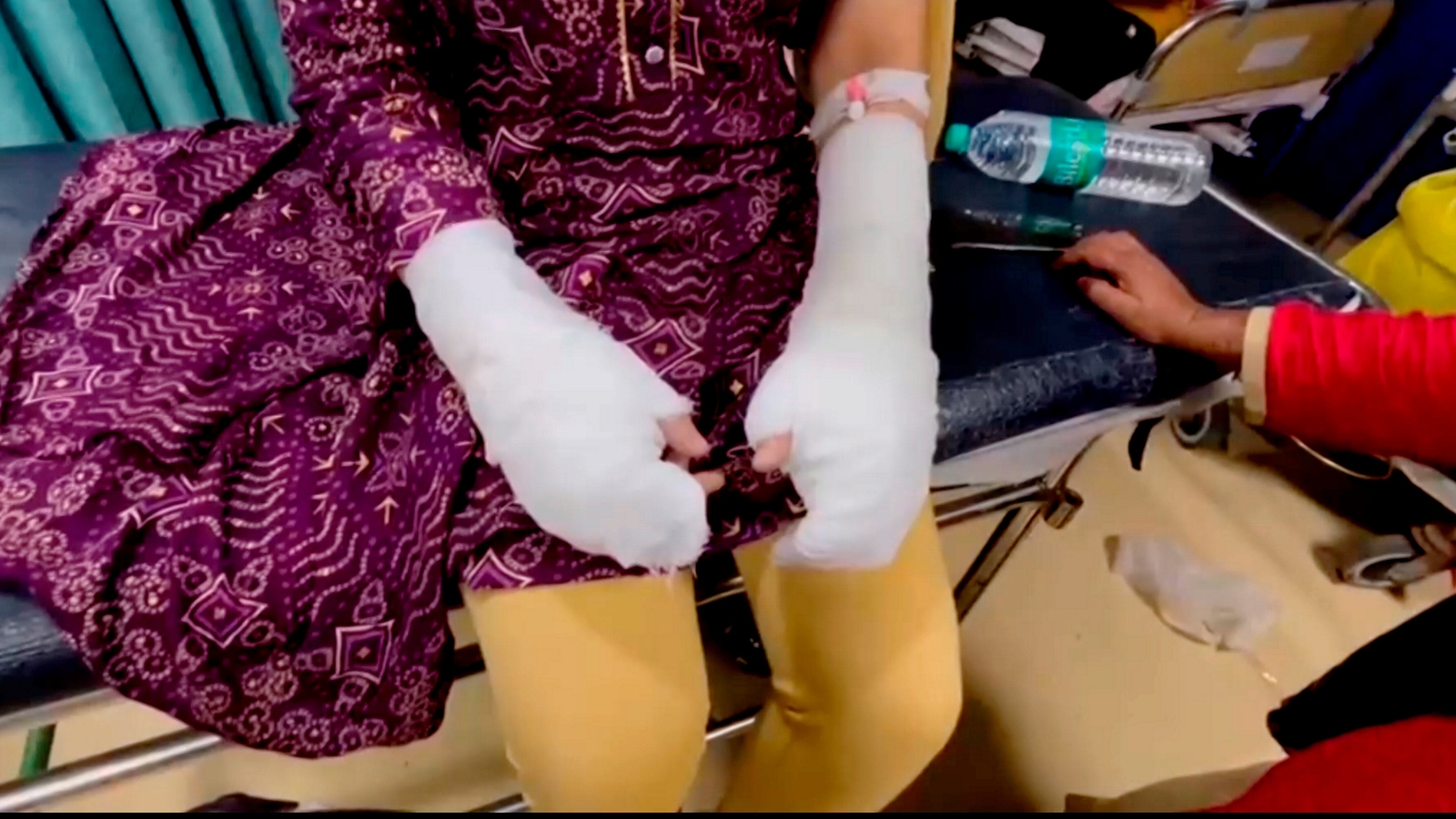 Fake acid, rape, and a property dispute: The bizarre Delhi case