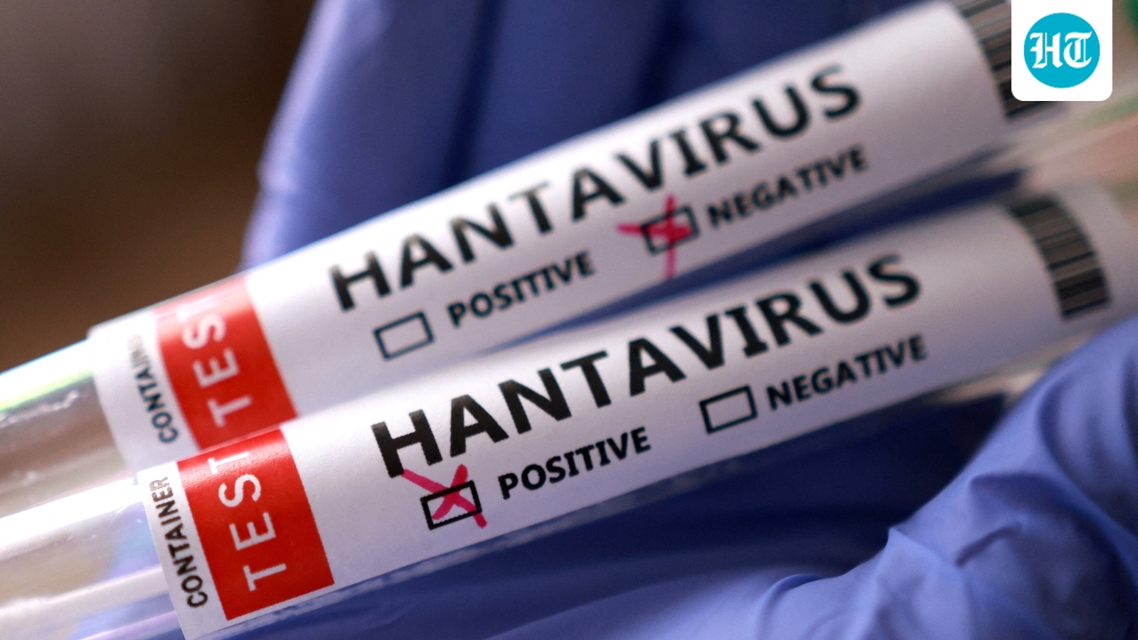 How worried should you be about hantavirus?