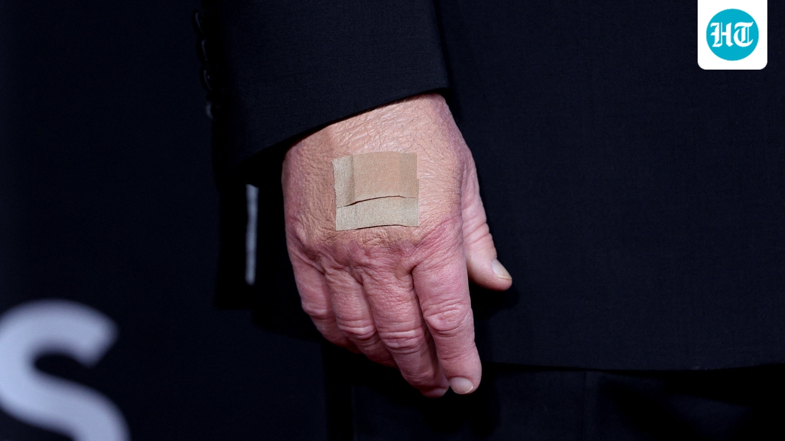 Trump health concerns: POTUS seen with bandaged right hand at Kennedy Center Honors dinner