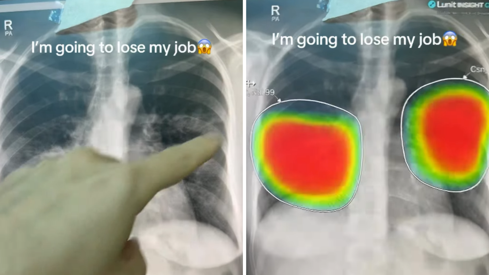 Dubai doctor says he might lose his job after AI analyses X-ray in seconds: 'I am applying to McDonald's'
