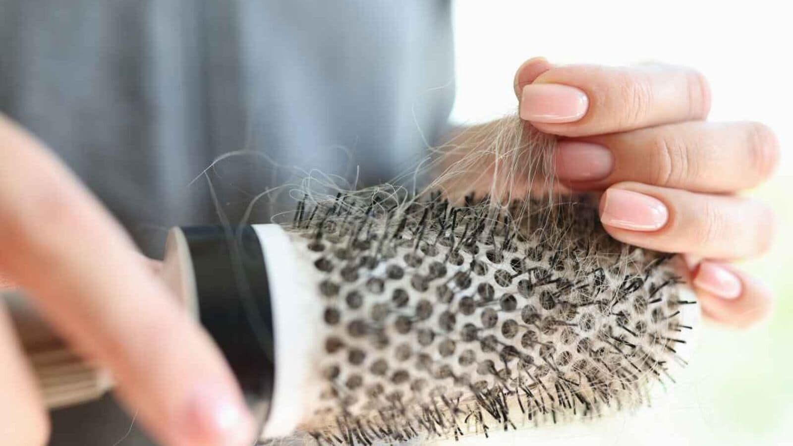 Hair loss isn’t just a man’s problem. Four ways to treat female baldness.