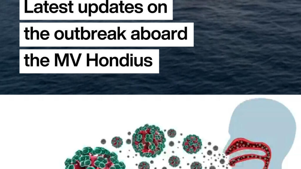 Hantavirus: Latest updates on the ongoing outbreak aboard the MV Hondius