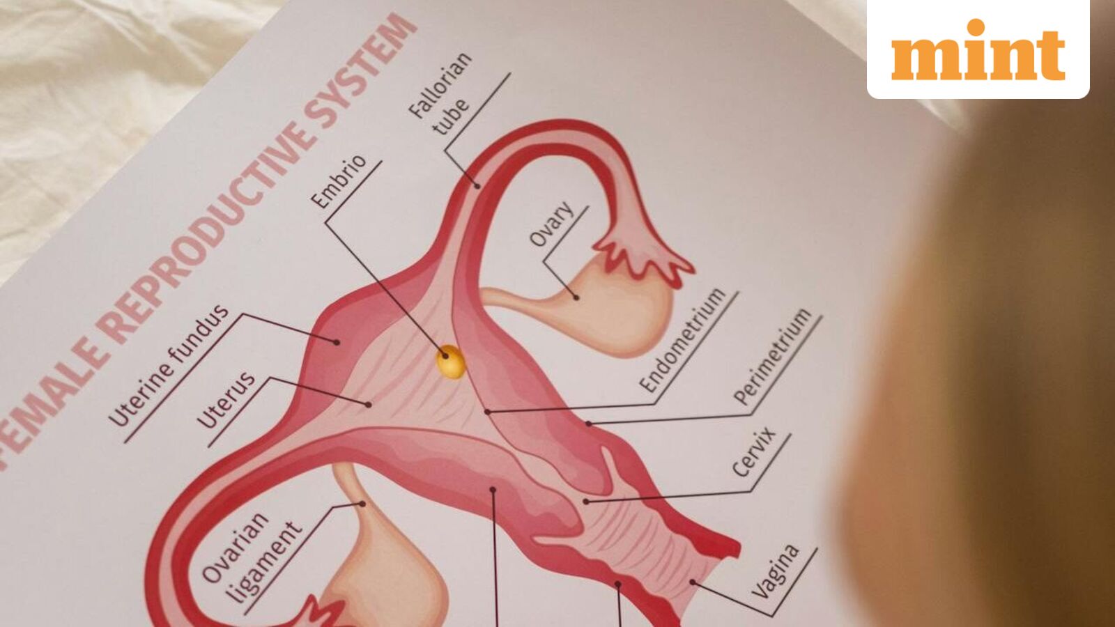 PCOS to be called PMOS as experts say old name caused confusion, delayed care