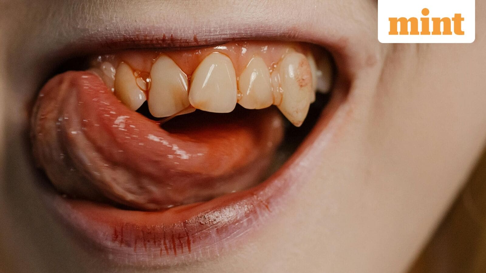 Pancreatic Cancer clues could be hiding in plain sight — in your mouth. Read what study says