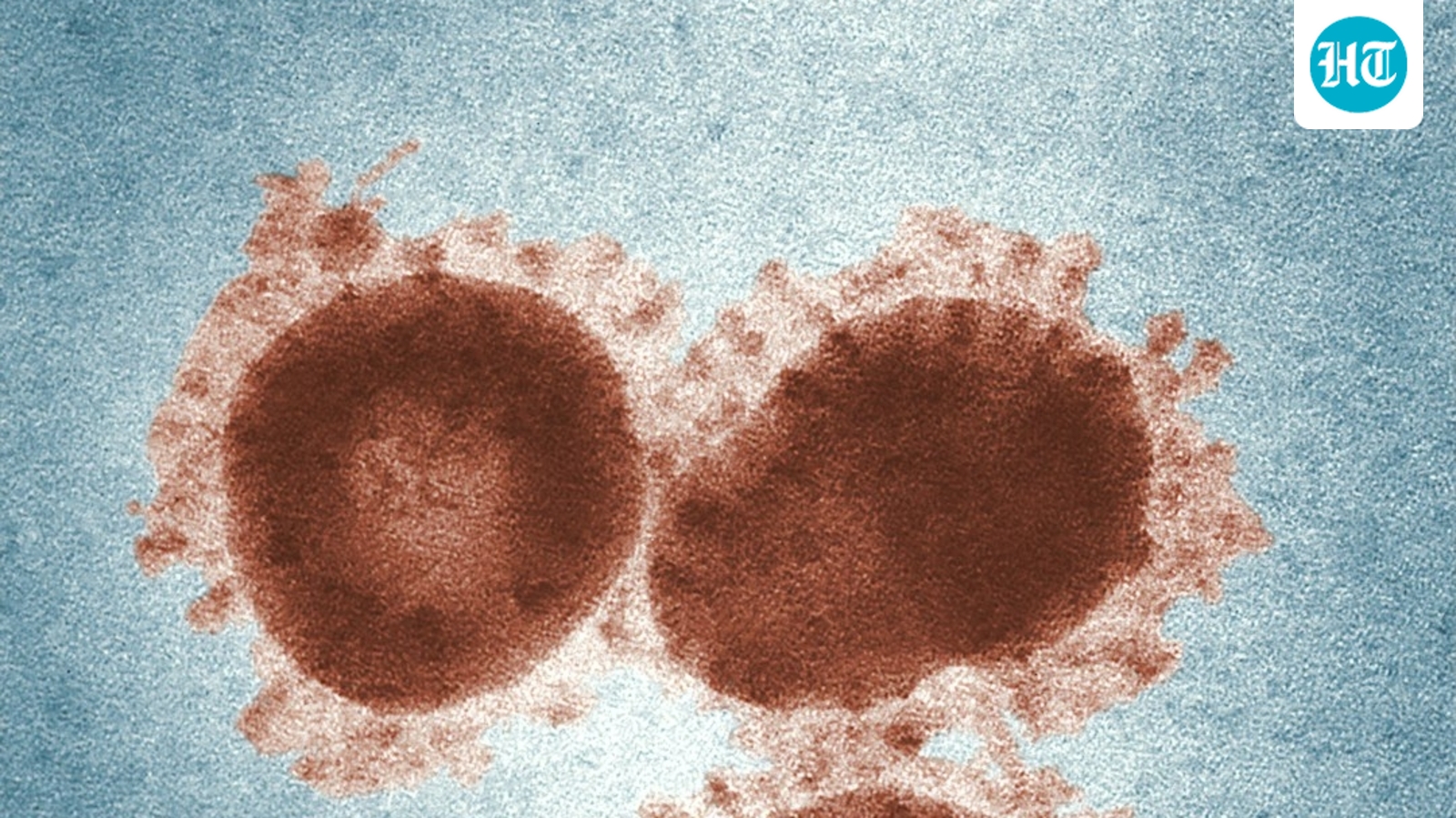 What is the 'vomit bug' spreading across the US? Everything to know about the highly contagious stomach virus