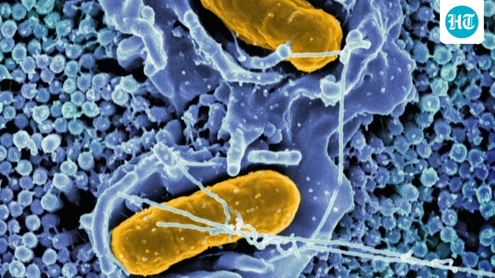 NHRC takes cognisance of ‘significant surge’ in Typhoid cases in Gujarat's Gandhinagar