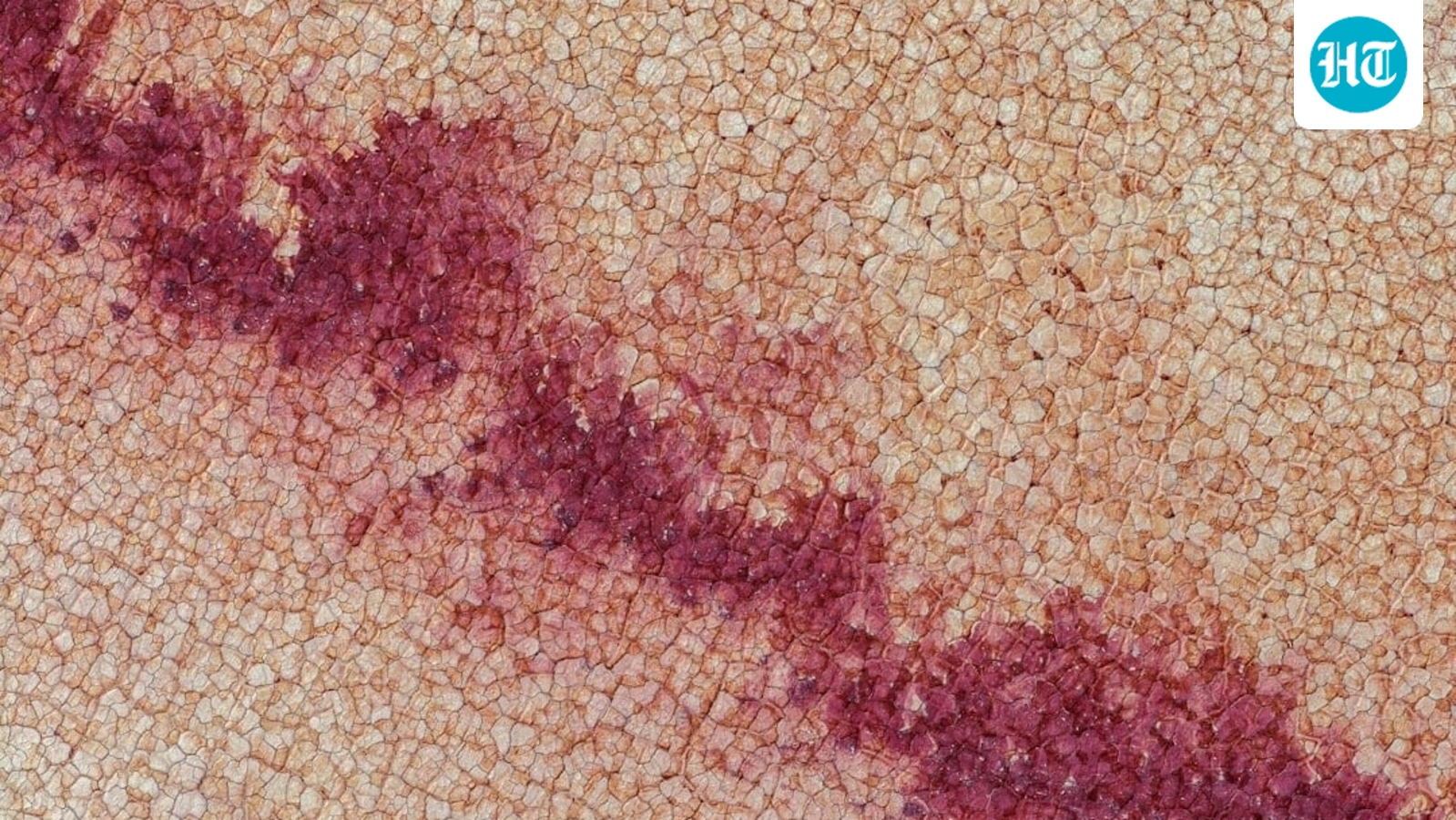 Cyclosporiasis outbreak in US: Everything you need to know about symptoms, spread, treatment and prevention